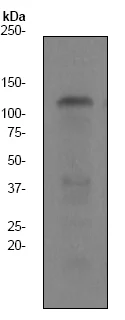 Western blot - Anti-KSR1 antibody [EPR2421Y] (AB68483)
