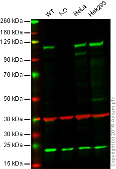 Western blot - Anti-KSR1 antibody [EPR2421Y] (AB68483)