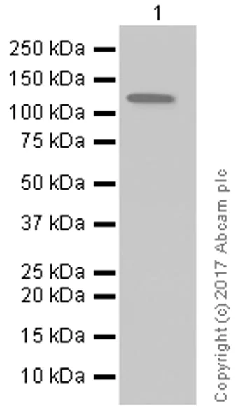 Western blot - Anti-KSR1 antibody [EPR2421Y] (AB68483)