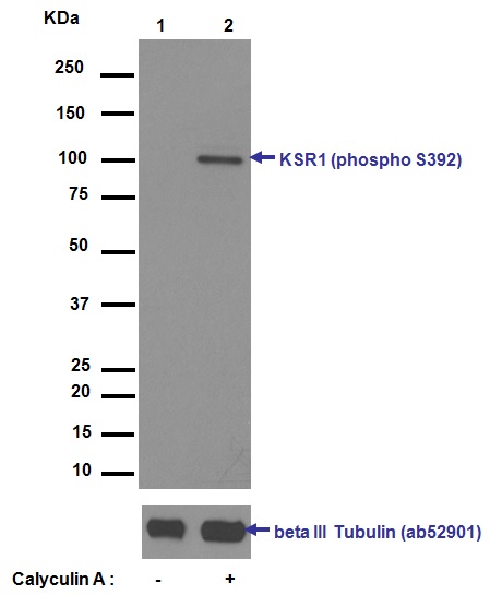 Western blot - Anti-KSR1 (phospho S392) antibody [EPR2359(2)] (AB129111)
