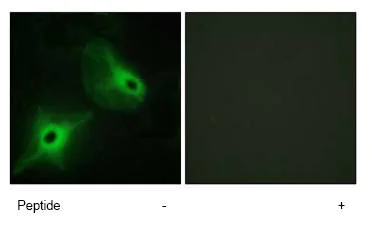 Immunocytochemistry/ Immunofluorescence - Anti-KSR2 antibody (AB72753)