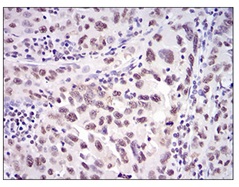 Immunohistochemistry (Formalin/PFA-fixed paraffin-embedded sections) - Anti-Ku70 antibody [2F7F5] (AB202022)