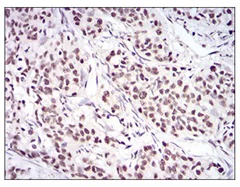 Immunohistochemistry (Formalin/PFA-fixed paraffin-embedded sections) - Anti-Ku70 antibody [2F7F5] (AB202022)