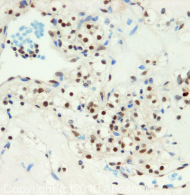 Immunohistochemistry (Formalin/PFA-fixed paraffin-embedded sections) - Anti-Ku70 antibody (AB83501)