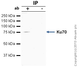 Anti-Ku70 antibody