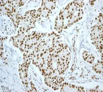 Immunohistochemistry (Formalin/PFA-fixed paraffin-embedded sections) - Anti-Ku70 antibody [EPR4026] - BSA and Azide free (AB247695)