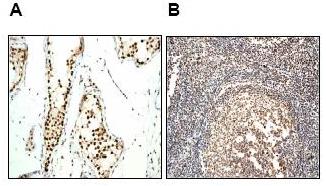 Immunohistochemistry (Formalin/PFA-fixed paraffin-embedded sections) - Anti-Ku70 antibody [EPR4027] - BSA and Azide free (AB239912), expandable thumbnail