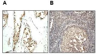 Immunohistochemistry (Formalin/PFA-fixed paraffin-embedded sections) - Anti-Ku70 antibody [EPR4027] - BSA and Azide free (AB239912)