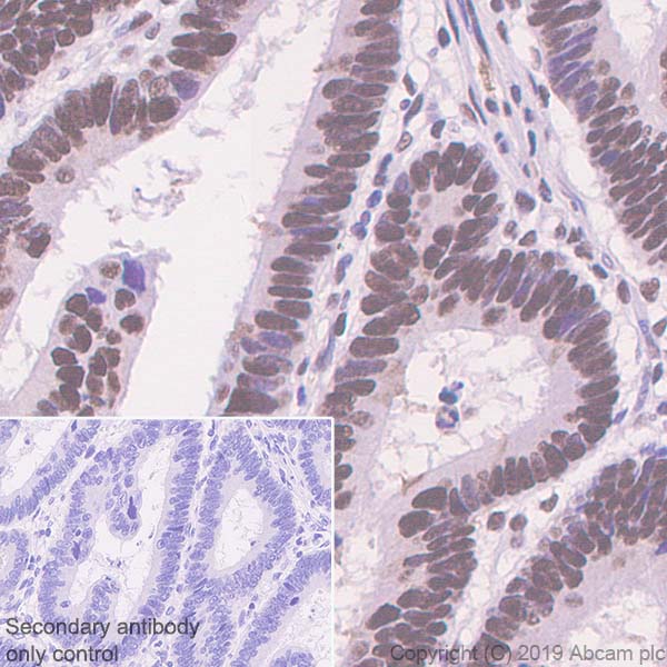 Immunohistochemistry (Formalin/PFA-fixed paraffin-embedded sections) - Anti-Ku70 antibody [EPR4027] - BSA and Azide free (AB239912), expandable thumbnail