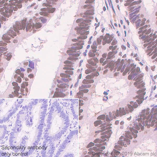 Immunohistochemistry (Formalin/PFA-fixed paraffin-embedded sections) - Anti-Ku70 antibody [EPR4027] - BSA and Azide free (AB239912)