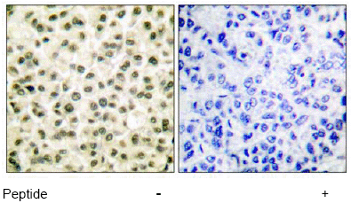 Immunohistochemistry (Formalin/PFA-fixed paraffin-embedded sections) - Anti-Ku70 + Ku80 antibody (AB53126), expandable thumbnail