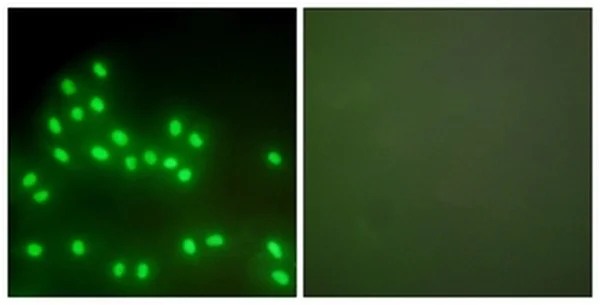 Immunocytochemistry/ Immunofluorescence - Anti-Ku70 + Ku80 antibody - C-terminal (AB166822)