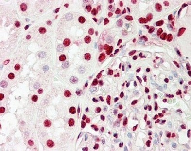 Immunohistochemistry (Formalin/PFA-fixed paraffin-embedded sections) - Anti-Ku70 + Ku80 antibody - C-terminal (AB166822), expandable thumbnail