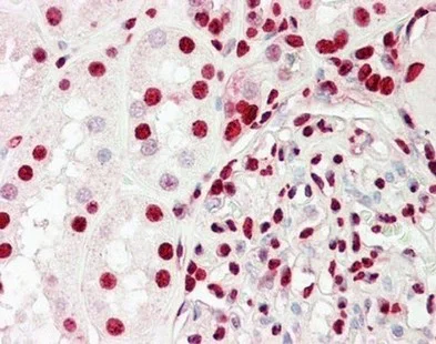 Immunohistochemistry (Formalin/PFA-fixed paraffin-embedded sections) - Anti-Ku70 + Ku80 antibody - C-terminal (AB166822)