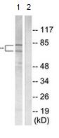 Western blot - Anti-Ku70 + Ku80 antibody - C-terminal (AB166822), expandable thumbnail