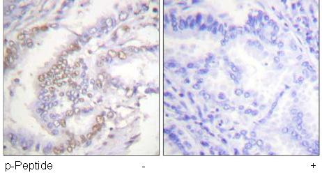 Immunohistochemistry (Formalin/PFA-fixed paraffin-embedded sections) - Anti-Ku70 (phospho S5) antibody (AB61783)