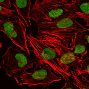 Immunocytochemistry/ Immunofluorescence - Anti-Ku80 antibody [5C5] (AB119935), expandable thumbnail