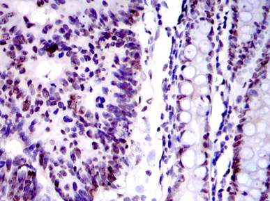 Immunohistochemistry (Formalin/PFA-fixed paraffin-embedded sections) - Anti-Ku80 antibody [5C5] (AB119935), expandable thumbnail