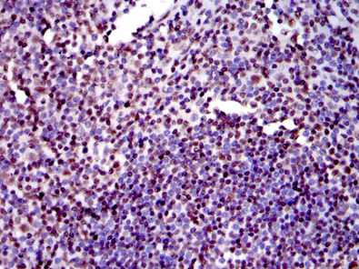 Immunohistochemistry (Formalin/PFA-fixed paraffin-embedded sections) - Anti-Ku80 antibody [5C5] (AB119935), expandable thumbnail