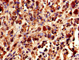 Immunohistochemistry (Formalin/PFA-fixed paraffin-embedded sections) - Anti-Ku80 antibody (AB236277), expandable thumbnail