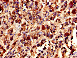 Immunohistochemistry (Formalin/PFA-fixed paraffin-embedded sections) - Anti-Ku80 antibody (AB236277)