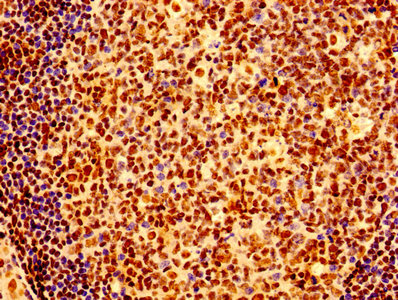 Immunohistochemistry (Formalin/PFA-fixed paraffin-embedded sections) - Anti-Ku80 antibody (ab236277), expandable thumbnail