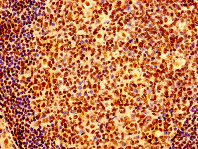 Immunohistochemistry (Formalin/PFA-fixed paraffin-embedded sections) - Anti-Ku80 antibody (AB236277)