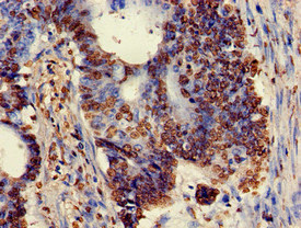 Immunohistochemistry (Formalin/PFA-fixed paraffin-embedded sections) - Anti-Ku80 antibody (AB236277), expandable thumbnail