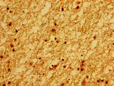 Immunohistochemistry (Formalin/PFA-fixed paraffin-embedded sections) - Anti-Ku80 antibody (ab236277), expandable thumbnail