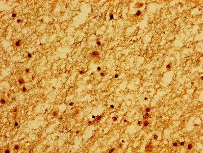 Immunohistochemistry (Formalin/PFA-fixed paraffin-embedded sections) - Anti-Ku80 antibody (AB236277)