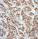 Immunohistochemistry (Formalin/PFA-fixed paraffin-embedded sections) - Anti-Ku80 antibody [EPR3467] - BSA and Azide free (AB247495), expandable thumbnail