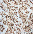 Immunohistochemistry (Formalin/PFA-fixed paraffin-embedded sections) - Anti-Ku80 antibody [EPR3467] - BSA and Azide free (AB247495)