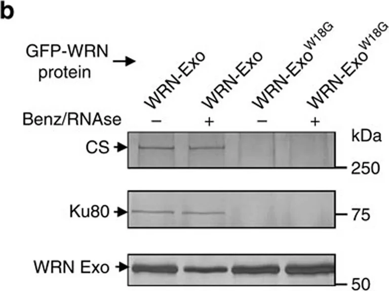 Western blot - Anti-Ku80 antibody [EPR3468] (AB80592)