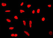 Immunocytochemistry/ Immunofluorescence - Anti-Ku80 antibody [EPR3468] - BSA and Azide free (AB232381), expandable thumbnail