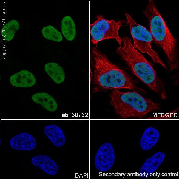 Immunocytochemistry/ Immunofluorescence - Anti-Ku80 antibody [SP130] (AB130752)