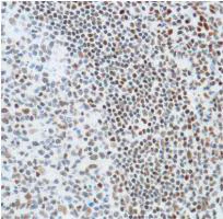 Immunohistochemistry (Formalin/PFA-fixed paraffin-embedded sections) - Anti-Ku80 antibody [SP130] (AB130752)
