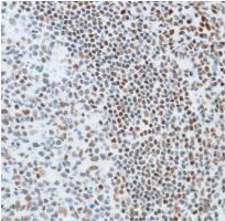 Immunohistochemistry (Formalin/PFA-fixed paraffin-embedded sections) - Anti-Ku80 antibody [SP130] - BSA and Azide free (AB245748), expandable thumbnail
