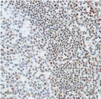 Immunohistochemistry (Formalin/PFA-fixed paraffin-embedded sections) - Anti-Ku80 antibody [SP130] - BSA and Azide free (AB245748)