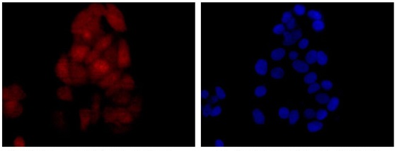 Immunocytochemistry/ Immunofluorescence - Anti-kur antibody [EPR13320-66] - BSA and Azide free (AB250399), expandable thumbnail
