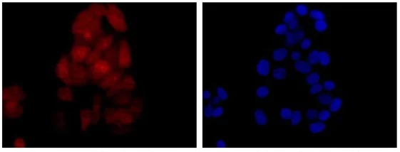 Immunocytochemistry/ Immunofluorescence - Anti-kur antibody [EPR13320-66] - BSA and Azide free (AB250399)
