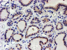 Immunohistochemistry (Formalin/PFA-fixed paraffin-embedded sections) - Anti-Kv beta 1/KCNAB1 antibody [OTI9F7] (AB236393)