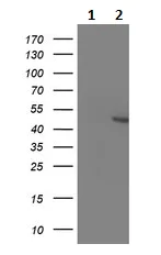 Western blot - Anti-Kv beta 1/KCNAB1 antibody [OTI9F7] (AB236393)