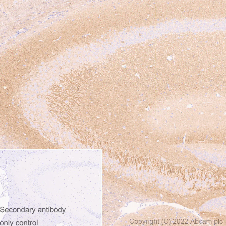Immunohistochemistry (Formalin/PFA-fixed paraffin-embedded sections) - Anti-Kv1.1 potassium channel antibody [K36/15] (AB300664)