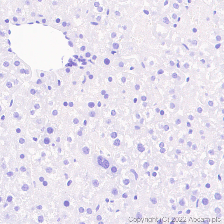 Immunohistochemistry (Formalin/PFA-fixed paraffin-embedded sections) - Anti-Kv1.1 potassium channel antibody [K36/15] (AB300664)