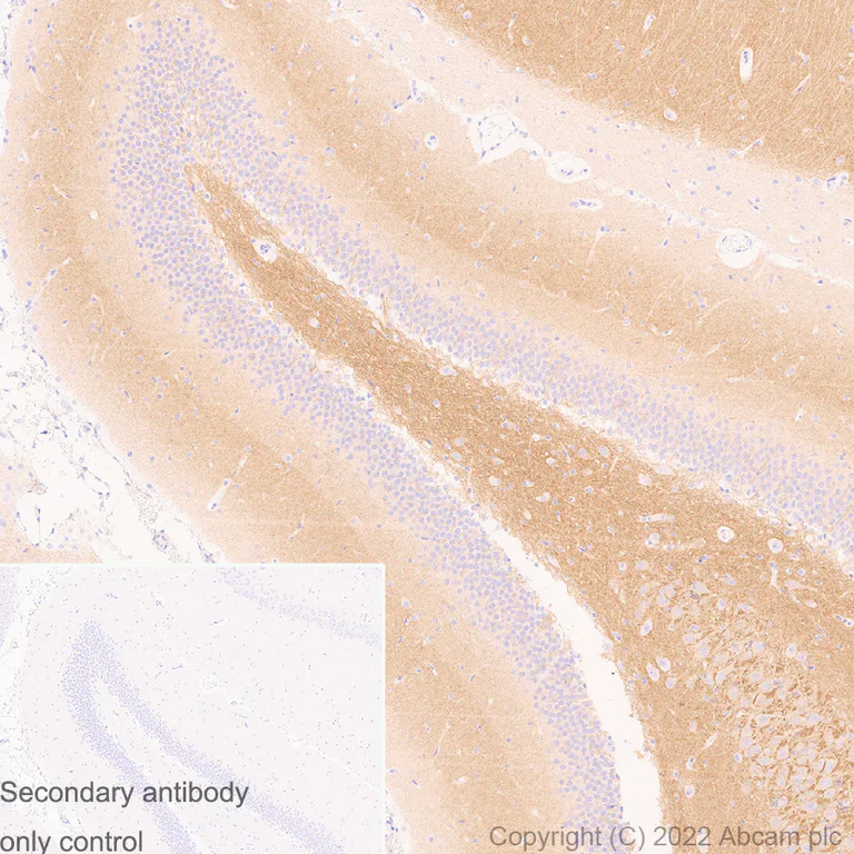 Immunohistochemistry (Formalin/PFA-fixed paraffin-embedded sections) - Anti-Kv1.1 potassium channel antibody [K36/15] (AB300664)