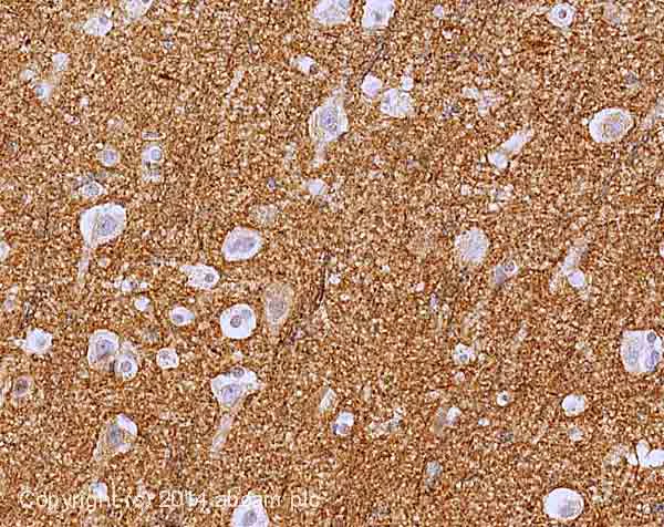 Immunohistochemistry (Formalin/PFA-fixed paraffin-embedded sections) - Anti-Kv1.2 antibody [K14/16] (AB192758)