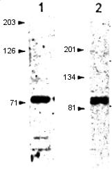 Western blot - Anti-Kv1.4/RK3 antibody (AB16718), expandable thumbnail