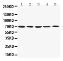 Western blot - Anti-Kv1.4/RK3 antibody (AB191052)