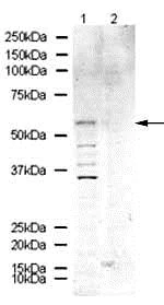 Western blot - Anti-Kv1.6/RCK2 antibody (AB21089)