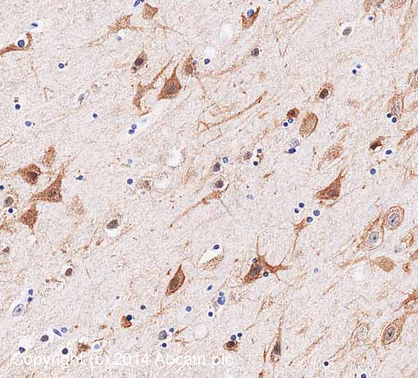 Immunohistochemistry (Formalin/PFA-fixed paraffin-embedded sections) - Anti-Kv2.1/KCNB1 antibody [K89/34] (AB192761)